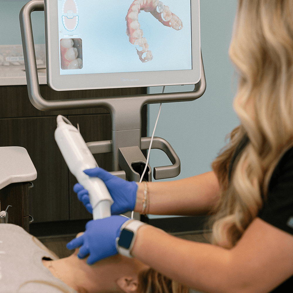 Invisalign® Aligners